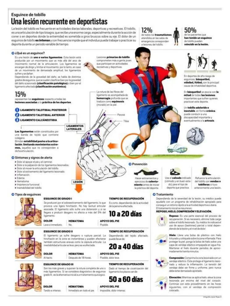 Infografía: Esguince de tobillo